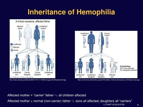 PPT - Hemophilia A: FAQ & Management Guidelines PowerPoint Presentation ...