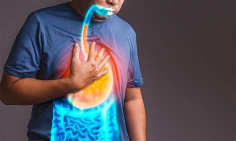 Endoscopic Anti Reflux mucosectomy effective treatment option for ...