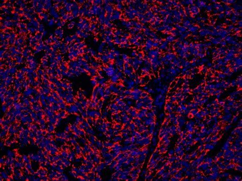 CoraLite®Plus 594-Tyramide Reagent PR30024 | Proteintech