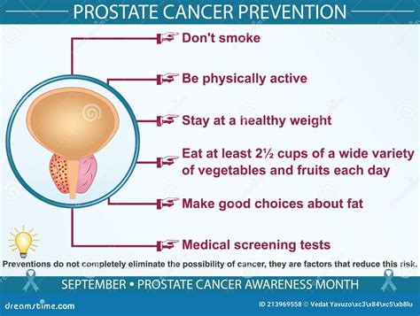 What Prevents Prostate Cancer In Men
