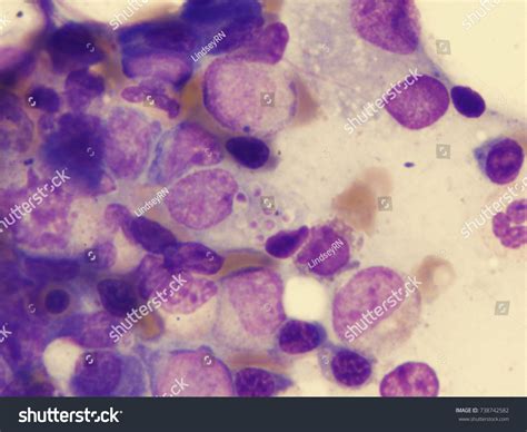 Histoplasmosis Wright-giemsa Stain Stock Photo 738742582 | Shutterstock
