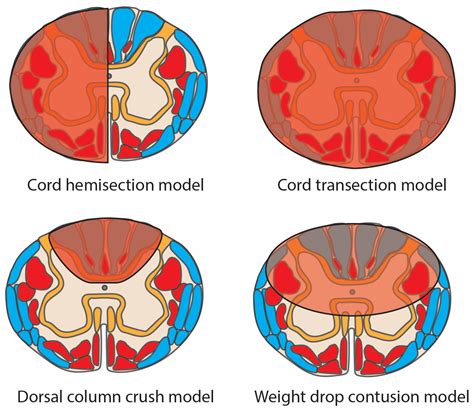 Neurotrauma—From Injury to Repair: Clinical Perspectives, Cellular ...