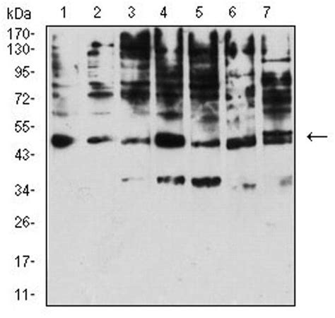 KIR3DL1 Antibody (MA5-31787)