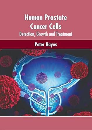 Buy Human Prostate Cancer Cells: Detection, Growth and Treatment Book ...