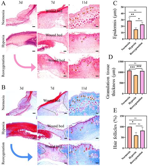 Reoxygenation Modulates the Adverse Effects of Hypoxia on Wound Repair