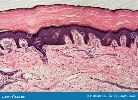 Human Epidermis Microscope
