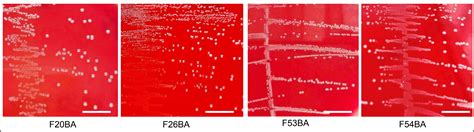 Selection and characterization of probiotic Enterococcus strains ...