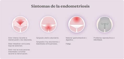 Endometriose: O Que É, Sintomas E Como Diagnosticar - INGL