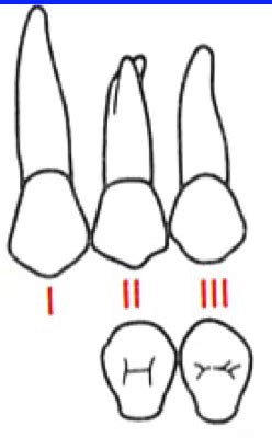 Image result for Tooth Mobility Classification Chart
