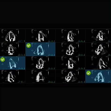 Philips - EPIQ Elite A new class of premium ultrasound has arrived ...