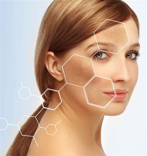 Dark Spots on Face: Ultimate Guide to Rid of Them In 2024 - beautybybie