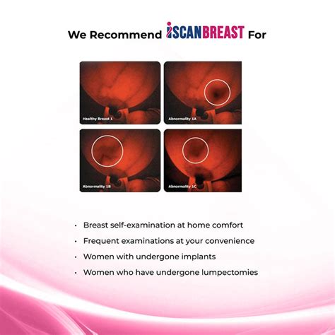 Buy Breast Self-Examination Device Online – iSCANBREAST