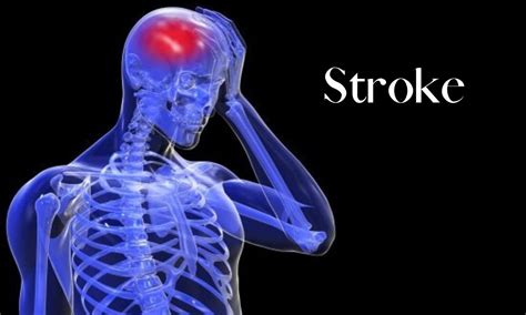 Lightheadedness or dizziness may be symptom of AF, cardiomyopathy or stroke