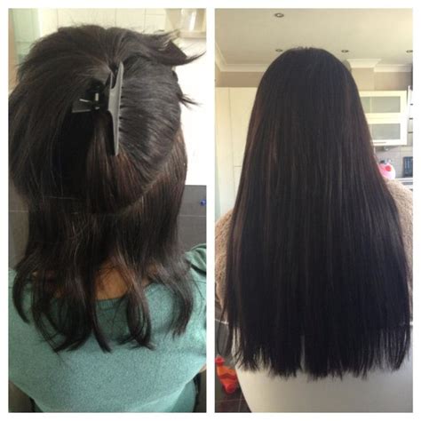 Image result for Applying Micro Loop Extensions