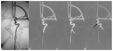 AngioSim: A Novel Augmented-Reality Angiography Simulator for Radiation ...