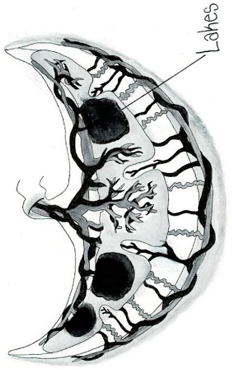 What Is the Significance of Placental Lakes in Pregnancy? A Historic ...