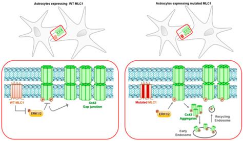 Megalencephalic Leukoencephalopathy with Subcortical Cysts Disease ...