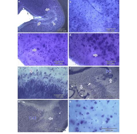 Image result for Neocortex Disorders