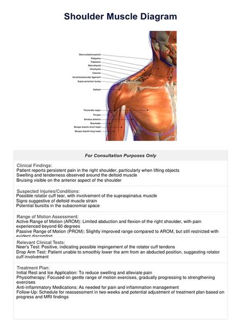 Shoulder Muscle Diagram & Example | Free PDF Download