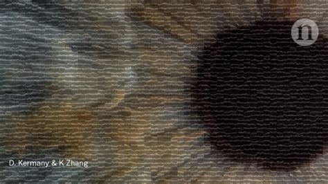 Image result for Eye Diseases Google Engineer Machine Learning