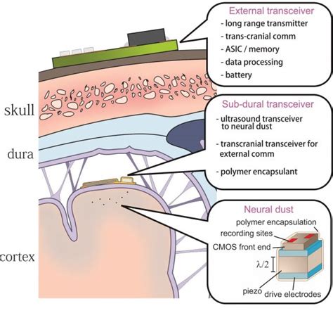 Image result for Neural Dust