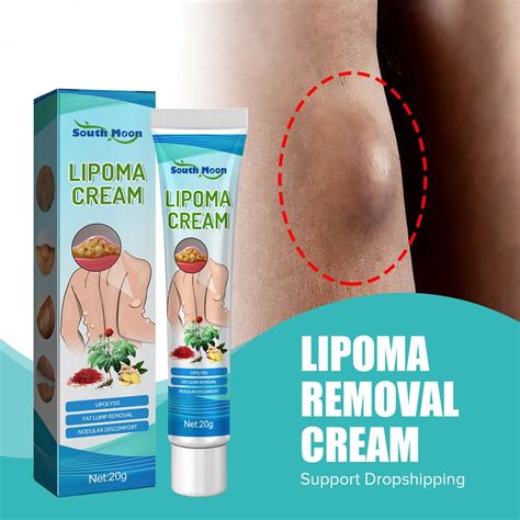 South Moon Lipoma Removal Cream Treatment Skin Swelling Lipolysis Fat Lump Cellulite Elimination ...
