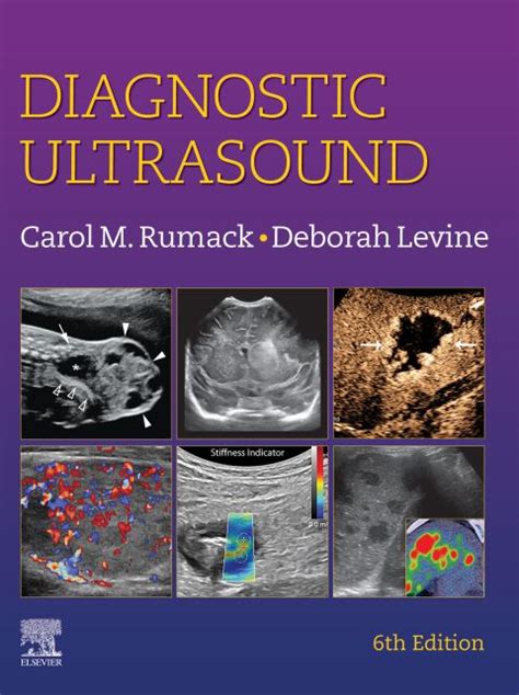Diagnostic Ultrasound E-Book: 6th edition | Edited by Carol M. Rumack ...