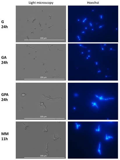 Aspergillus fumigatus, One Uninucleate Species with Disparate Offspring