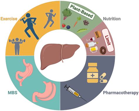 Obesity Management in the Primary Prevention of Hepatocellular Carcinoma