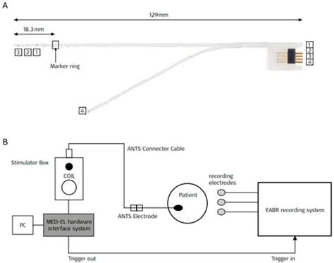 Audiology Research | An Open Access Journal from MDPI