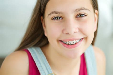Braces and Self-Esteem - Virginia Family Dentistry