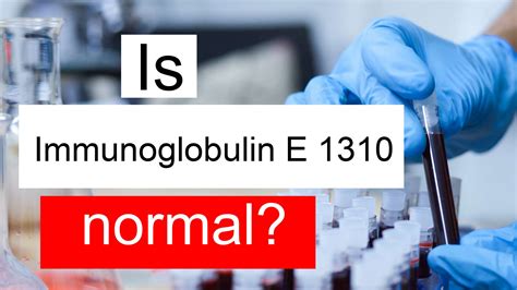 Is Immunoglobulin E 1310 high, normal or dangerous? What does IgE level 1310 mean?
