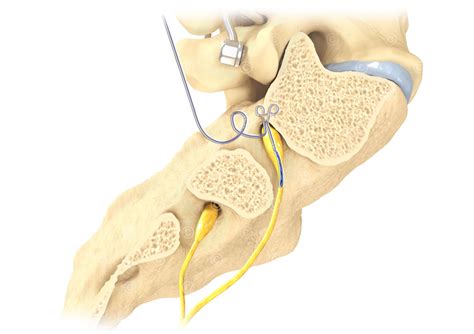 Image result for DRG Rotation Guide