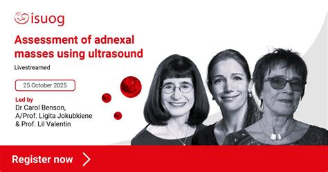 Assessment of adnexal masses using ultrasound, Online event, London ...