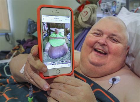 130-pound tumor removed from Mississippi man who was told he was just ...