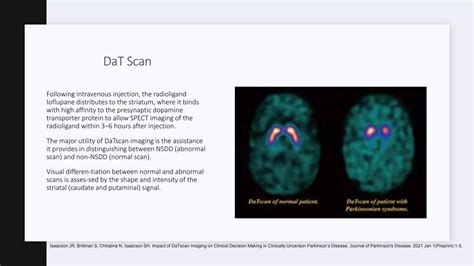The Role of DaT Scan in Diagnosing Parkinson Disease | PPTX