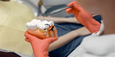 Overview Your Dental Budget & Root Canal Treatment Costs