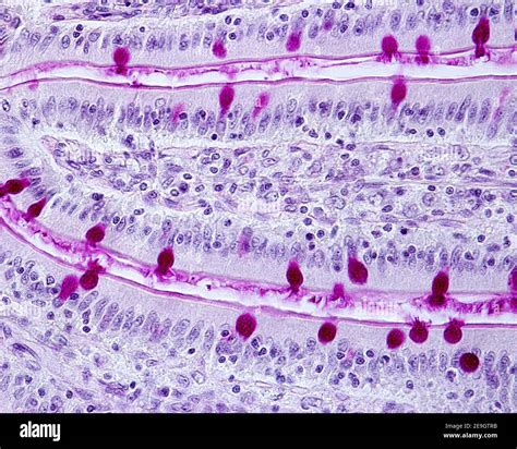 Intestinal villi stained with the Periodic Acid Schiff (PAS) staining ...