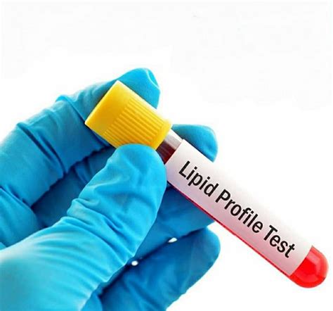 SDPC Path Lab Pvt Ltd