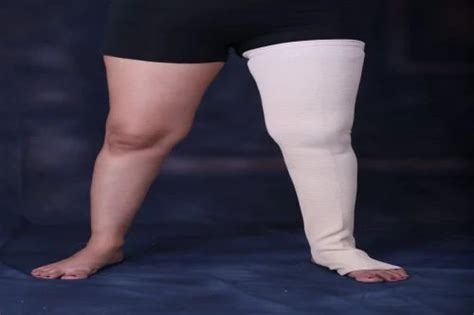 Full Leg Compression Stockings 的图像结果