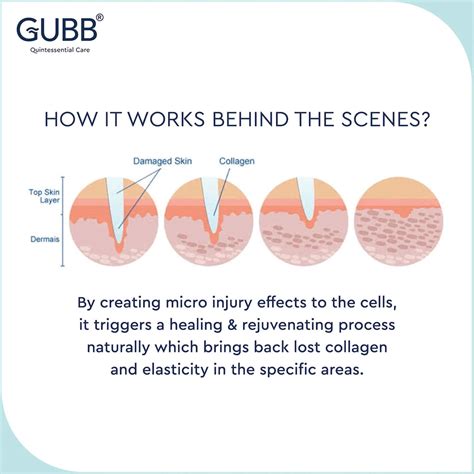 Buy GUBB DERMA ROLLER 0.5MM FOR HAIR REGROWTH FACE ACNE SCARS & SKIN ...