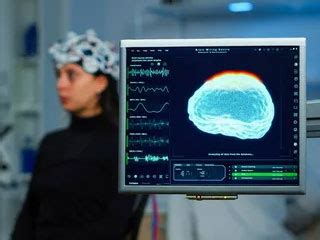 Image result for MATLAB Qeeg Brain Map