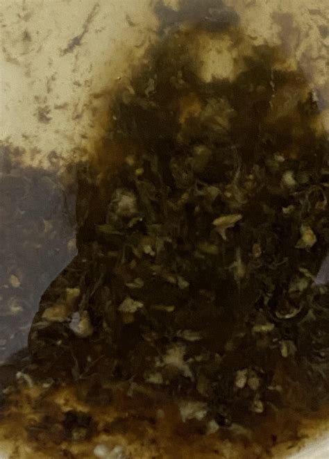 NSFW SPOILER photo of white flecks in fluffy stool-what is it?!? : r ...