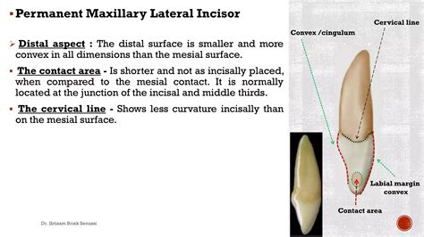 Maxillary lateral incisor. | PDF