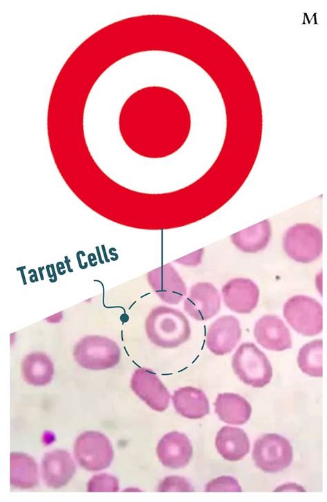 Image result for Target Cells