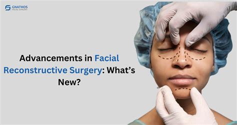 Facial Reconstructive Surgery Cost – VCOG