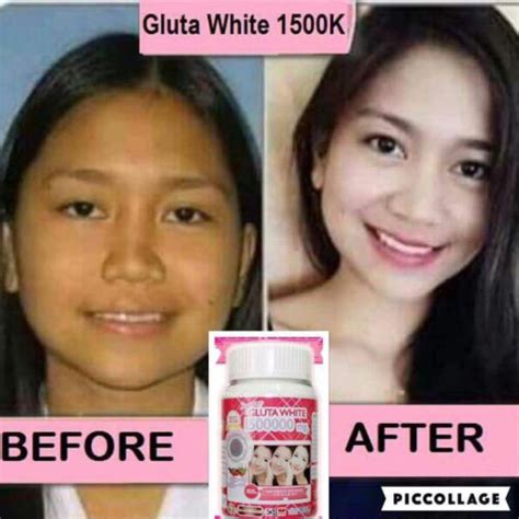 Supreme Gluta White - Skin Whitening & Anti-Aging India | Ubuy