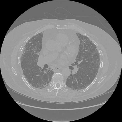 Image result for Python-Opencv Padding