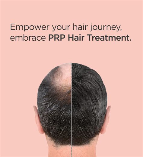 Address Your Hair Loss Issues with Hair PRP Treatment | Kaya