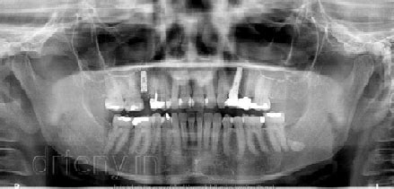 Premier dental Clinic